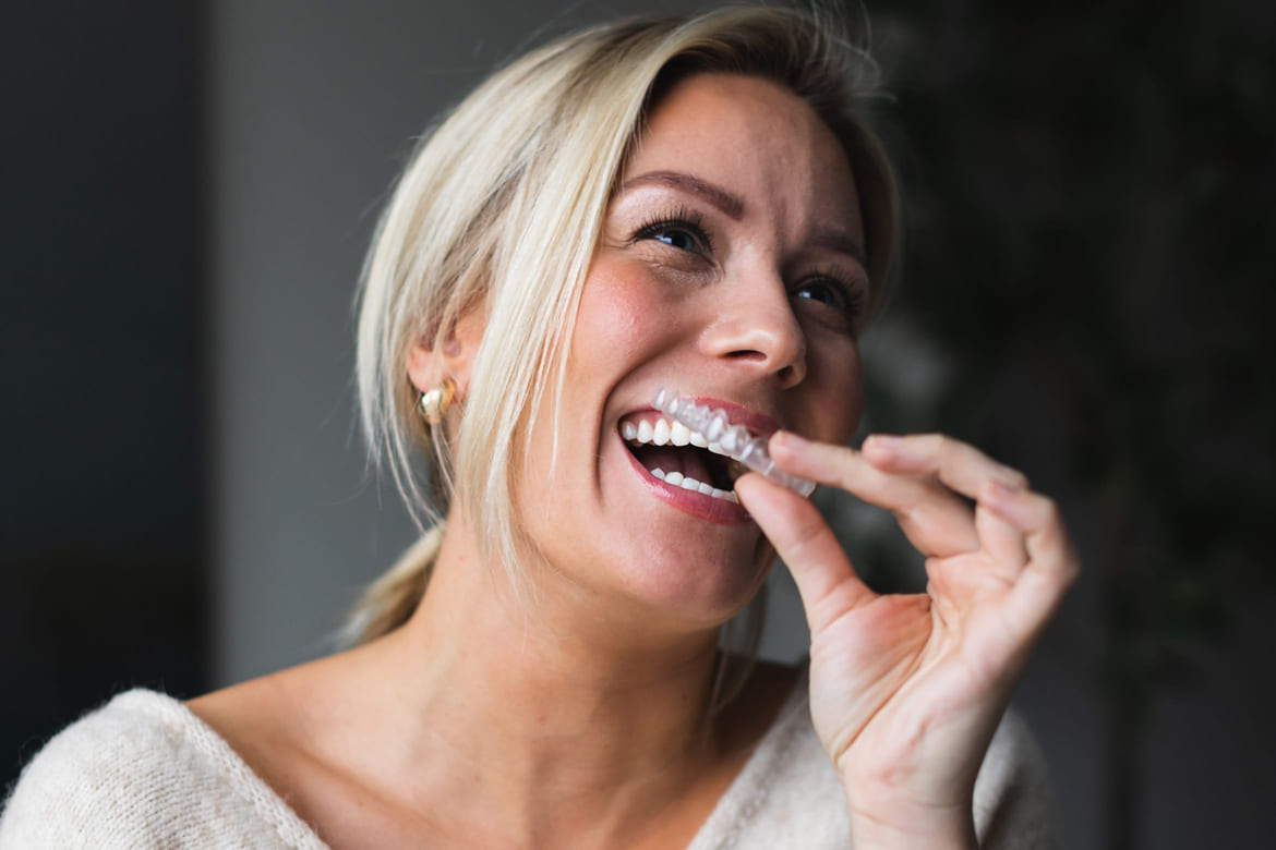 Dame med Invisalign tannreguleringsskinner, usynlig tannregulering