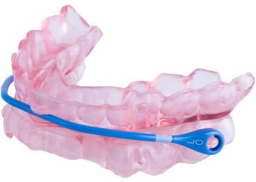Apnéskinne består av en plastgom tilpasset tennene.
©Picture provided with permission of SomnoMed®